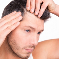 infoltimento_capelli7